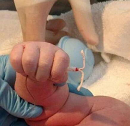 一名女子避孕2年仍然怀上身孕，宝宝出生时手上竟握着一个东西